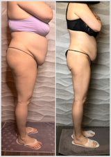 KETO TRANSFORMATION PRO