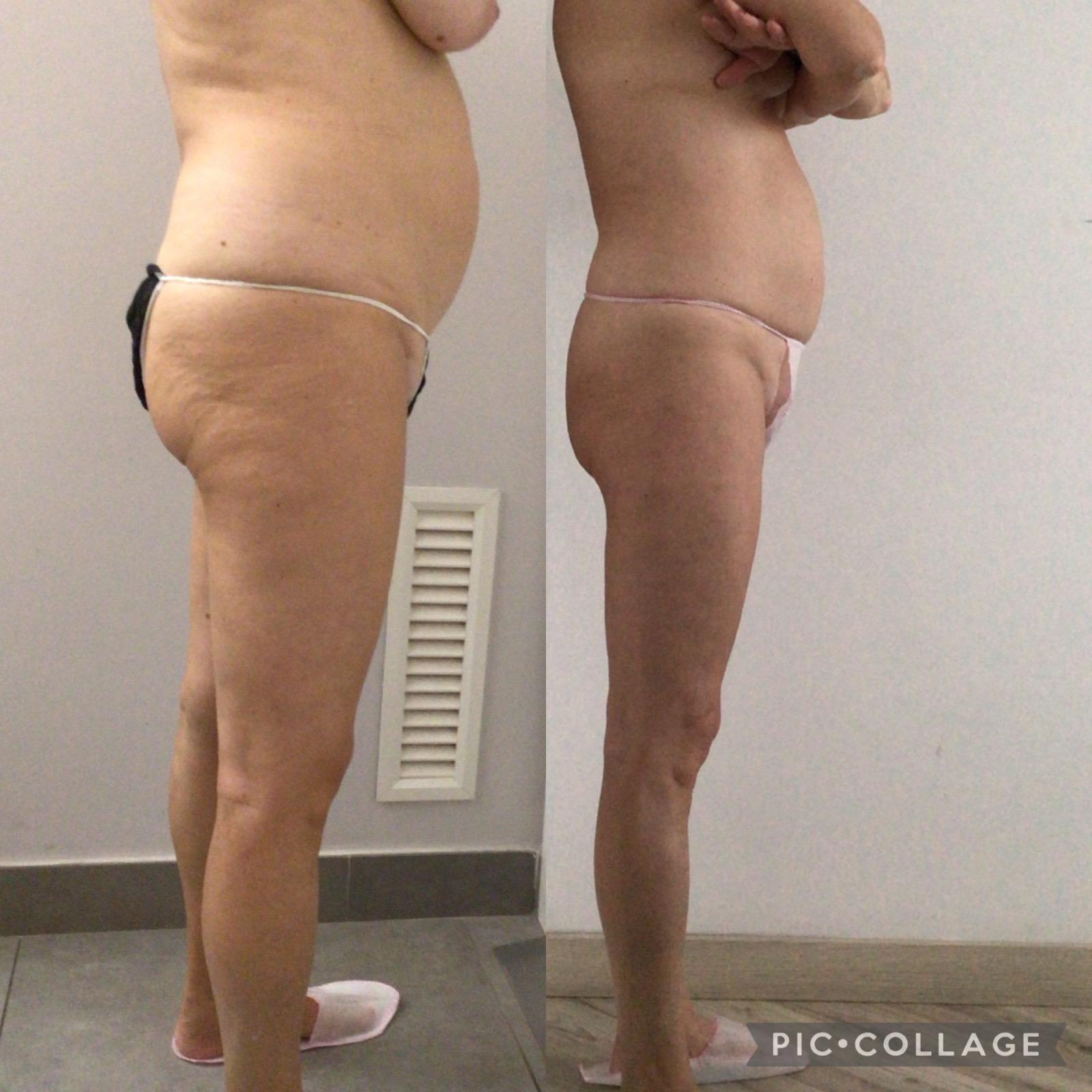 KETO TRANSFORMATION PRO