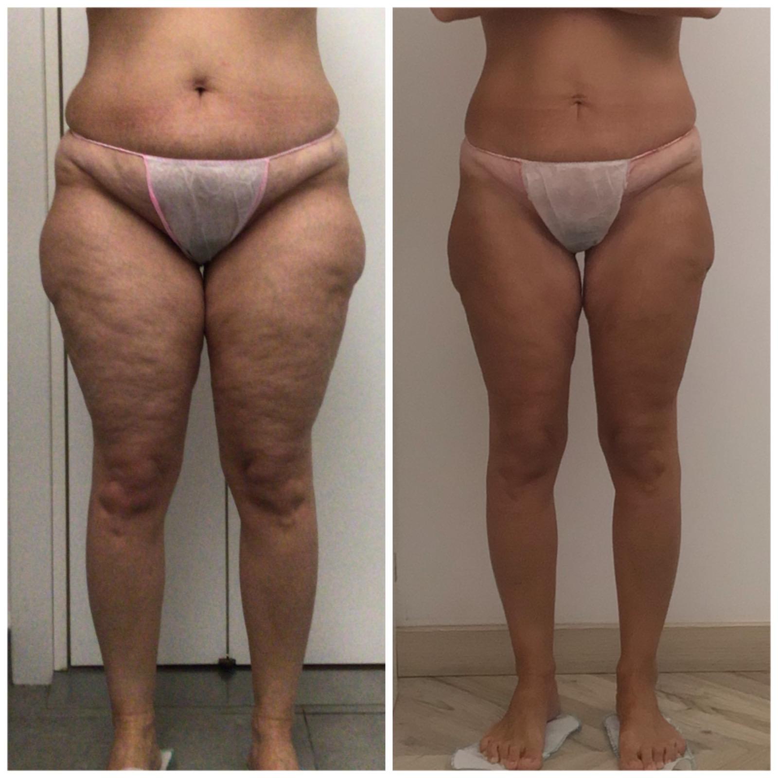 KETO TRANSFORMATION PRO